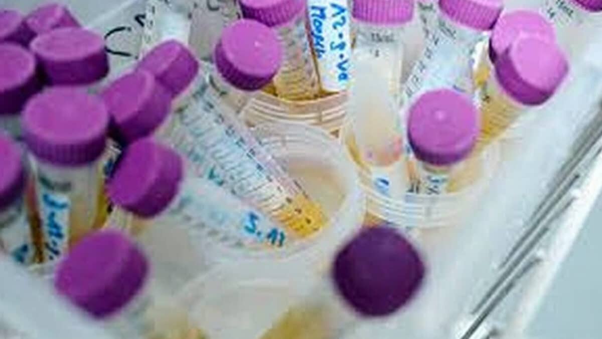 benzen creme protecție solară