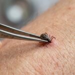 Cum se scot corect căpușele și ce metode interzic medicii în 2026