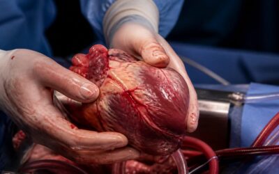 Primul transplant de inimă de la Institutul de Boli Cardiovasculare din Iași a salvat un pacient de 44 de ani