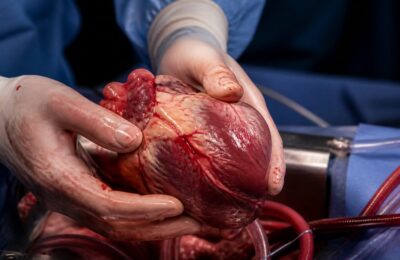 Primul transplant de inimă de la Institutul de Boli Cardiovasculare din Iași a salvat un pacient de 44 de ani